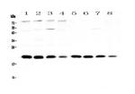 BNIP3 Antibody in Western Blot (WB)