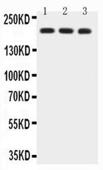 BRCA1 Antibody in Western Blot (WB)