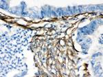 Caldesmon Antibody in Immunohistochemistry (Paraffin) (IHC (P))