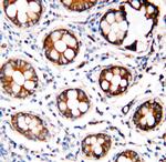 Calmodulin Antibody in Immunohistochemistry (Paraffin) (IHC (P))