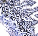 HP1 gamma Antibody in Immunohistochemistry (Paraffin) (IHC (P))