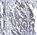 HP1 gamma Antibody in Immunohistochemistry (Paraffin) (IHC (P))