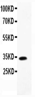 MCP-4 Antibody in Western Blot (WB)