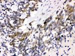 CDK4 Antibody in Immunohistochemistry (Paraffin) (IHC (P))