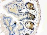 CDK4 Antibody in Immunohistochemistry (Paraffin) (IHC (P))