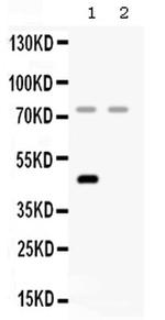 Complement Factor I Antibody in Western Blot (WB)