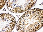 JAB1 Antibody in Immunohistochemistry (Paraffin) (IHC (P))