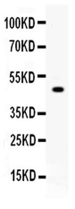 Carboxypeptidase B2 Antibody in Western Blot (WB)