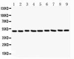 CSK Antibody in Western Blot (WB)