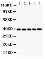 CXCR6 Antibody in Western Blot (WB)