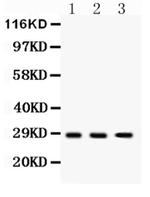 DKK2 Antibody in Western Blot (WB)