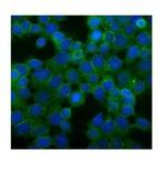 Desmoglein 2 (DSG2) Antibody in Immunocytochemistry (ICC/IF)