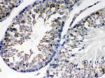 EBAG9 Antibody in Immunohistochemistry (Paraffin) (IHC (P))