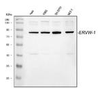 HERV Antibody in Western Blot (WB)