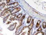 ETV6 Antibody in Immunohistochemistry (Paraffin) (IHC (P))