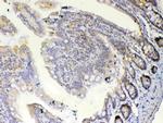 ETV6 Antibody in Immunohistochemistry (Paraffin) (IHC (P))