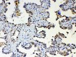 ETV6 Antibody in Immunohistochemistry (Paraffin) (IHC (P))