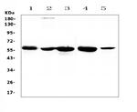 ETV6 Antibody in Western Blot (WB)