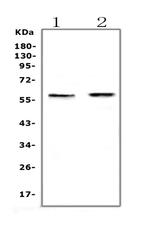 ETV6 Antibody in Western Blot (WB)