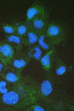 FABP2 Antibody in Immunocytochemistry (ICC/IF)