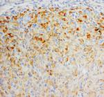 FGF8 Antibody in Immunohistochemistry (Paraffin) (IHC (P))