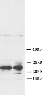 FGF8 Antibody in Western Blot (WB)