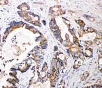 FGFR3 Antibody in Immunohistochemistry (Paraffin) (IHC (P))