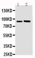 FGFR3 Antibody in Western Blot (WB)