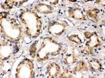 PLM Antibody in Immunohistochemistry (Paraffin) (IHC (P))