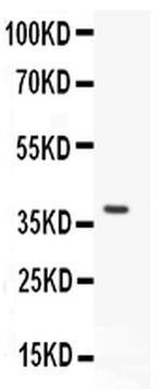 GFR alpha-1 Antibody in Western Blot (WB)