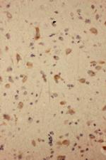 GluR2 Antibody in Immunohistochemistry (Paraffin) (IHC (P))