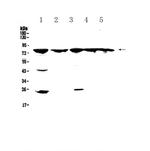 GRK2 Antibody in Western Blot (WB)