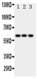 HEXA Antibody in Western Blot (WB)