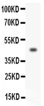 HOXA3 Antibody in Western Blot (WB)