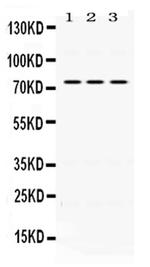 CD122 Antibody in Western Blot (WB)