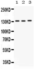 CD49a (Integrin alpha 1) Antibody in Western Blot (WB)