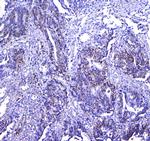 CD41 Antibody in Immunohistochemistry (Paraffin) (IHC (P))