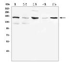 CD41 Antibody in Western Blot (WB)