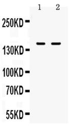 CD11a Antibody in Western Blot (WB)