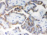 ITPR3 Antibody in Immunohistochemistry (Paraffin) (IHC (P))