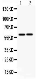 LTBR Antibody in Western Blot (WB)