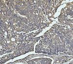 MEK3 Antibody in Immunohistochemistry (Paraffin) (IHC (P))