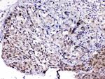 PCQAP Antibody in Immunohistochemistry (Paraffin) (IHC (P))