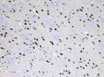 MED18 Antibody in Immunohistochemistry (Paraffin) (IHC (P))