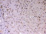 MED18 Antibody in Immunohistochemistry (Paraffin) (IHC (P))