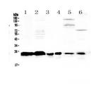 MED18 Antibody in Western Blot (WB)