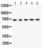 Menin Antibody in Western Blot (WB)