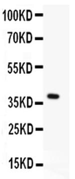 Menin Antibody in Western Blot (WB)