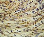 MMP16 Antibody in Immunohistochemistry (Paraffin) (IHC (P))