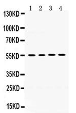 MMP8 Antibody in Western Blot (WB)